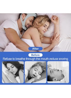Ocean Upgraded Anti Snoring Devices, Anti Snoring Chin Strap, Adjustable Chin Strap, Correction of Open Mouth Respiratory Resistance to Snoring Strap for Men and Women, Chin Straps Sleep Aids  - Image 5