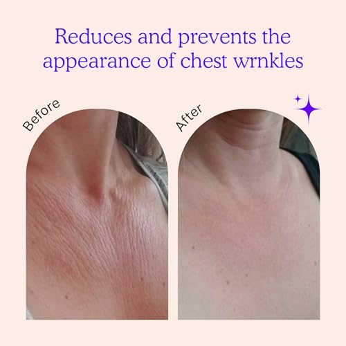 BLUMBODY Chest Wrinkle Pads – Anti-Wrinkle Silicone Patches Skin Firming, Smoothing – Reusable Overnight Chest Pad – Anti-Aging Crepe Erase Pads – Neck, Décolleté (1.5-Month Supply) - Image 2