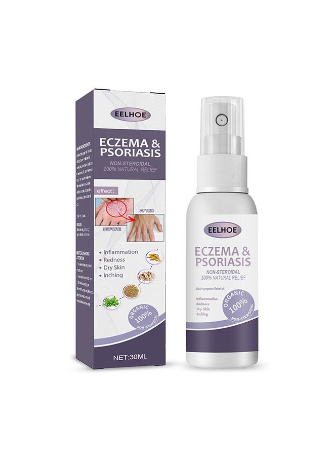 إيلهو الأكزيما والصدفية رذاذ رذاذ 30ml ، من ناحية القدم موس إصلاح الجلد ، مضاد للحكة ، العناية بالبشرة رذاذ ، مضاد للجراثيم ، لا تهيج آمنة - Image 1