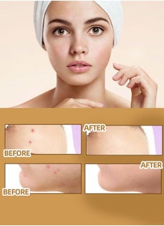 Jaysuing Scars Cover Up Sticker for Tattoos Acnes Birthmarks and Tags Natural Invisible Silicone Material Breathable Waterproof Sweat-proof Fake Skin Concealing Patch (60 PCS)  - Image 2