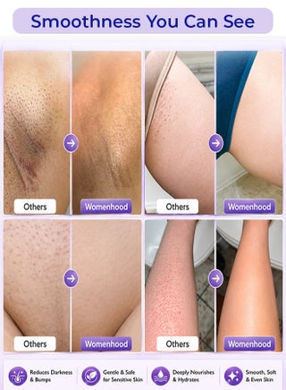 مجموعة إزالة شعر البكيني 5 في 1 من WOMENHOOD للنساء، تشمل أداة تشذيب شعر الوجه والجسم، ومنظف مسامير القدم، وماكينة حلاقة، ومقاومة للماء، ووقت تشغيل يصل إلى 120 دقيقة، وعناية دقيقة للنساء. - view 3