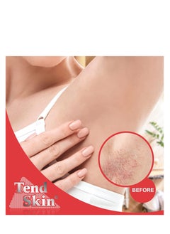 Tend Skin Tend Skin Womens AfterShave/Post Waxing Solution for Ingrown Hair, Razor Bumps and Burns, 4 ounce, Blue  - Image 3