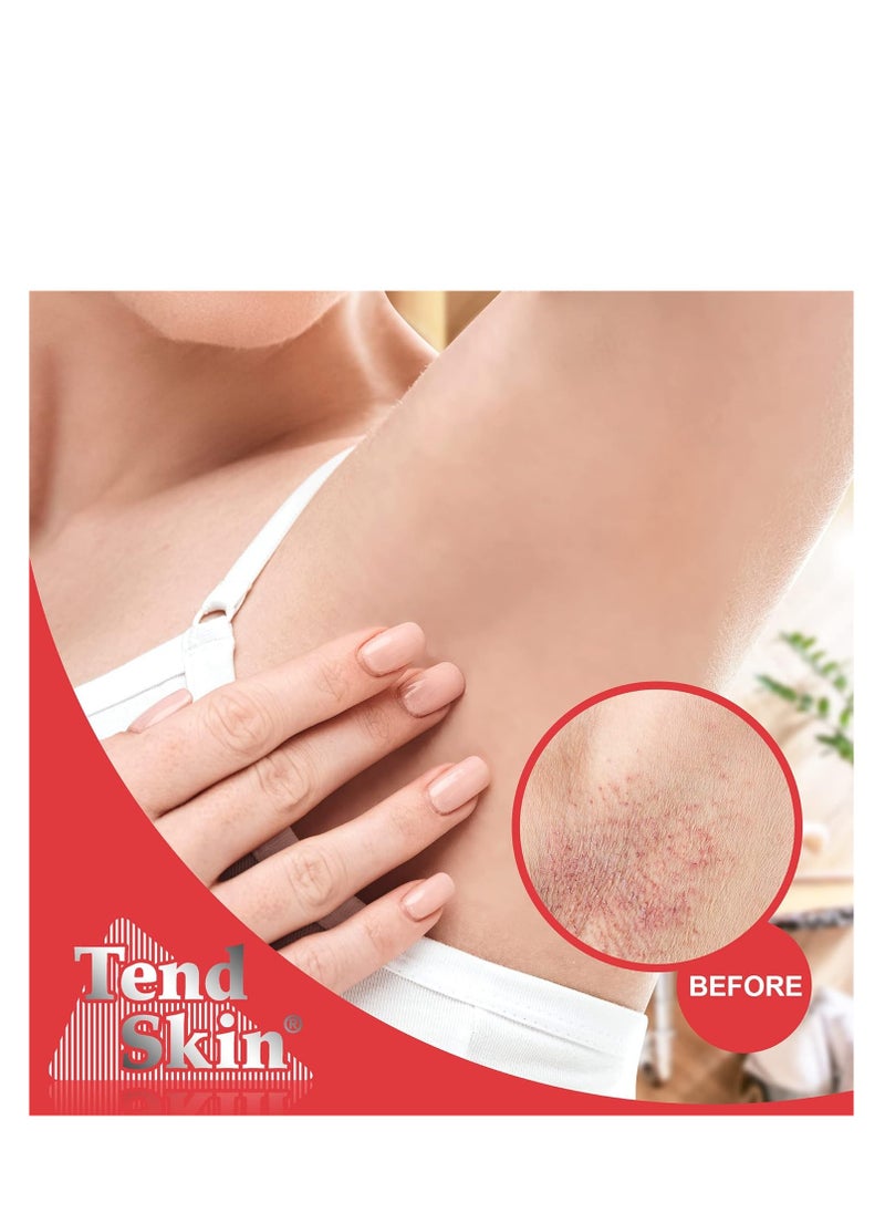 Tend Skin - Tend Skin Womens AfterShave/Post Waxing Solution for Ingrown Hair, Razor Bumps and Burns, 4 ounce, Blue - Image 1