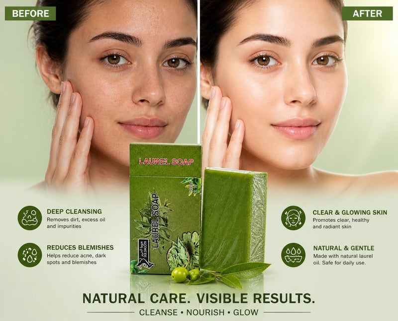 SILK SMOOTH Laurel Soap 100g – Natural Laurel Leaf Soap for Deep Cleansing, Acne Care & Skin Nourishment – Gentle Herbal Bar for Face & Body - Image 2