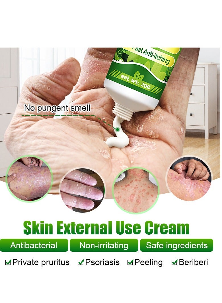 Antibacterial Cream for Psoriasis and Eczema Antifungal Cream, Helps Eczema, Ringworm Anti-Itch Cream with Gentler and Safer Herbal Ingredients Quickly Relives Itching for Face & Body