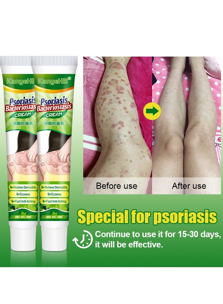 Antibacterial Cream for Psoriasis and Eczema Antifungal Cream, Helps Eczema, Ringworm Anti-Itch Cream with Gentler and Safer Herbal Ingredients Quickly Relives Itching for Face & Body