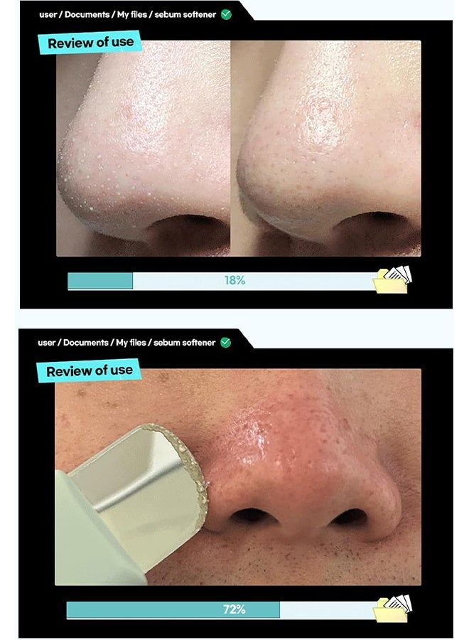 ILSO Super Melting Sebum Softener 150G, Sebum Remove Complex Centella Asiatica Extract, Carica Papaya Fruit Extract, Blackhead Remove, Melting Sebum Softener, Pores Cleanses - Image 5