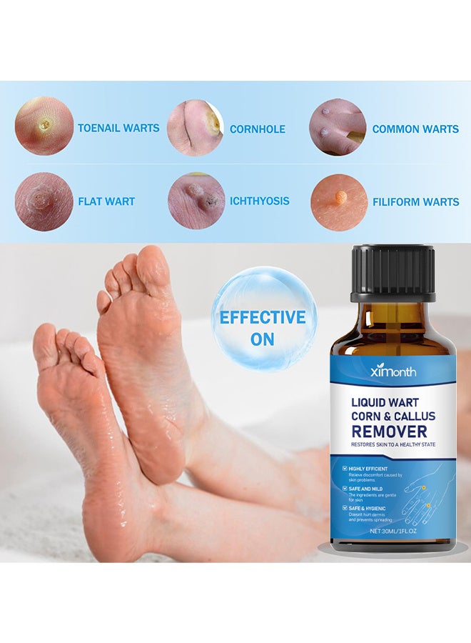 ximonth Liquid Wart Corn & Callus Remover 30ml, Fast Action Wart Remover Warts Removal Liquid With Salicylic Acid Remove Plantar Warts Common And Flat Wart Feet Corn Callus Treatment Liquid - Image 4