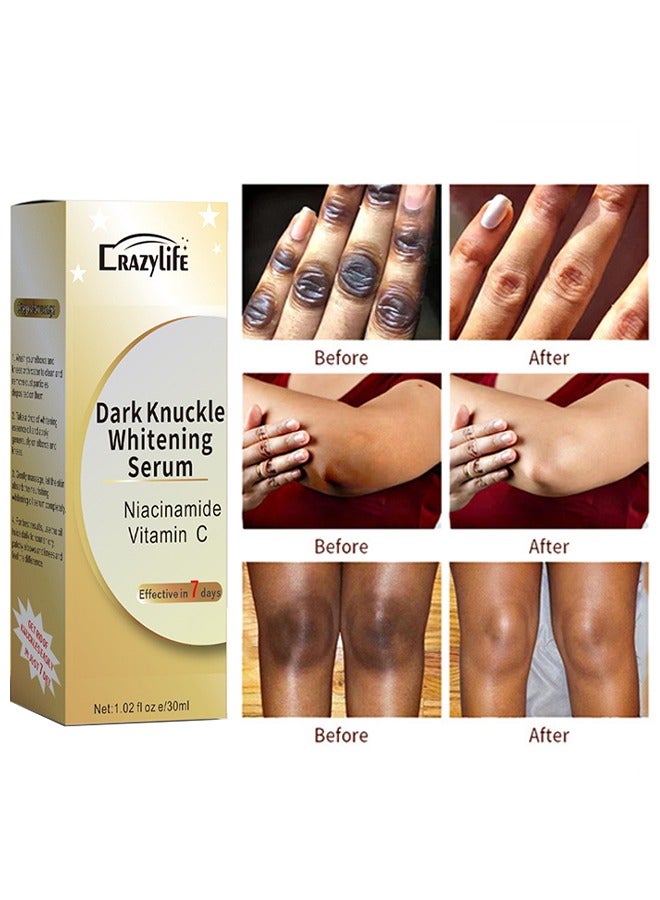 Crazylife Dark Knuckle Whitening Serum, Joint Darkening Serum, Lighten And Repair Melanin, Skin Care Removal Body Bleaching For Knuckle Elbows 30ml - Image 1