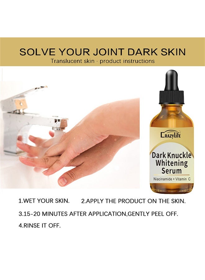 Crazylife Dark Knuckle Whitening Serum, Joint Darkening Serum, Lighten And Repair Melanin, Skin Care Removal Body Bleaching For Knuckle Elbows 30ml - Image 4
