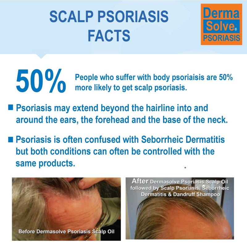 Dermasolve Scalp Psoriasis Medicated Shampoo & Conditioner - Naturally Heals Dandruff Seborrheic Dermatitis Itchy Flakey Inflamed Skin & Provides Soothing Moisturizing Relief - 8 oz bottles (2 Pack) - Image 2