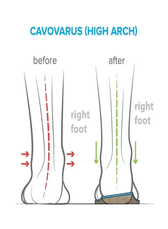 FootScientific® Arches Type 3 (High Arch) Orthotic Shoe Insoles, Men’s Size 11-11.5 / Women’s Size 13-13.5 - Image 4