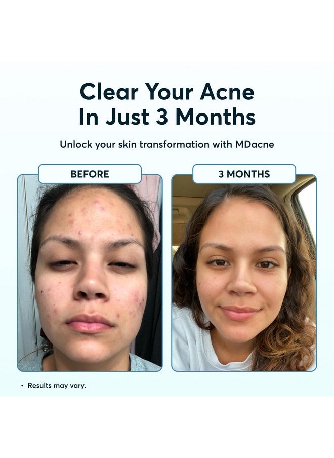 MDacne - 3 Step Retinol Acne Kit Retinol Cream 0.25% Salicylic Acid Cleanser Niacinamide Moisturizer Plantbased Products For Hormonal Acne Blemishes And Wrinkles. 30 Day Complete Acne Care Kit - Image 1
