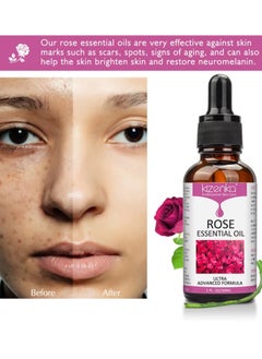 Rose Essential Oil Face Rose Oil Moisturizer Rose Oil Anti Ageing and Anti Wrinkle Serum Rose Oil for Face Skin Care Reduce Fine Lines and Skin Marks Face Serum with Rose Extract 30ml - pzsku/Z79A5AAFF77FBCC702E51Z/45/1741339695/1c95f611-4436-4fc0-b4a4-9120145c35ad