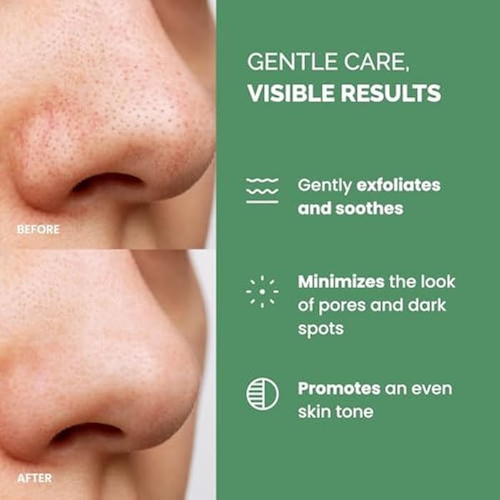 PLANTIFIQUE Korean Glycolic Acid Toner Pads 60 Pcs with Niacinamide, CICA - AHA BHA PHA Face Daily Peel Exfoliating Pads Formula for Gentle Skin Renewal for All Skin Types - Refillable Container - Image 2