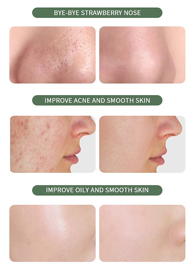 SADOER - Mugwort Anti Pores Acne Clay Stick Face Mask, Cleansing Mask Mud Mask For Men And Women, Moisturizing Oil Control Shrink Remove Blackheads, Shrink Pores, Improve Skin Tone 1PCS - Image 1