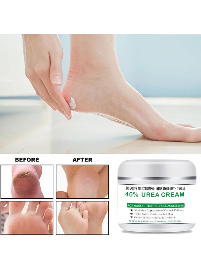 Crazylife 40% Urea Cream And 2% Salicylic Acid, Percent For Feet Maximum Strength, Callus Remover, Dead Skin Exfoliation, Hand And Foot Cream For Dry Cracked Hands, Elbows, Feet, Heels, Knees 100G  - Image 4