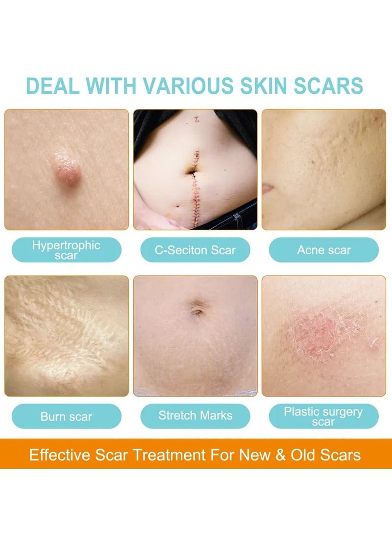 VOGSIG Silicone Scar Sheets 3.8m Medical Silicone Scar Tape Roll Easy Tear Soft Silicone Tape for Scars Removal Reusable Painless Silicone Sheets for Surgery Scars C Section Burn Keloid - Image 3