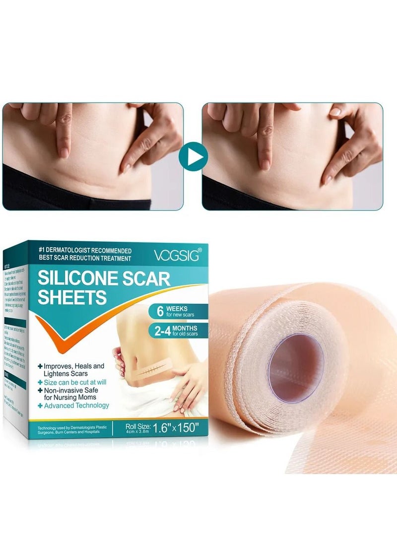VOGSIG Silicone Scar Sheets 3.8m Medical Silicone Scar Tape Roll Easy Tear Soft Silicone Tape for Scars Removal Reusable Painless Silicone Sheets for Surgery Scars C Section Burn Keloid - Image 2