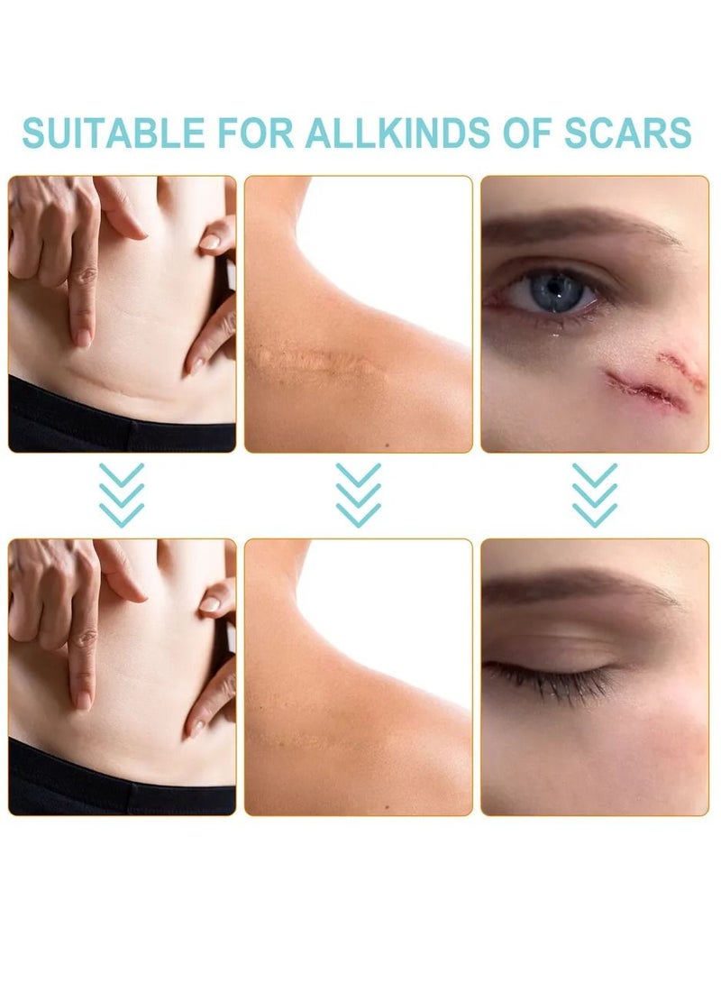 VOGSIG Silicone Scar Sheets 3.8m Medical Silicone Scar Tape Roll Easy Tear Soft Silicone Tape for Scars Removal Reusable Painless Silicone Sheets for Surgery Scars C Section Burn Keloid - Image 4