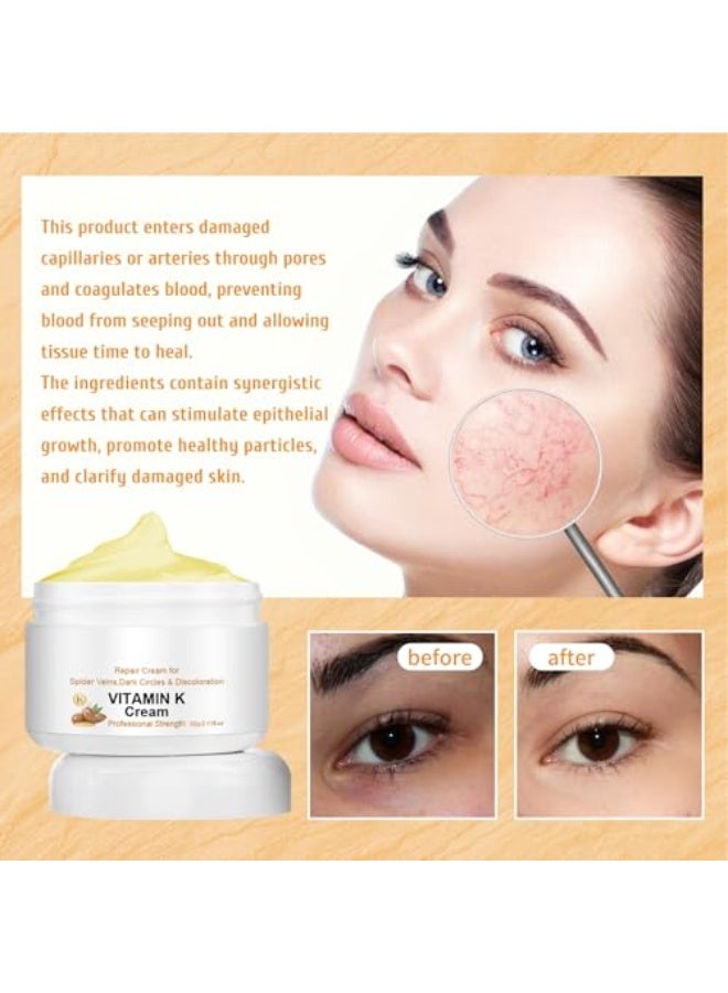 EELHOE Vitamin K Professional Strength Repair Cream for Spider Veins, Dark Circles and Discoloration, 60g - Image 2