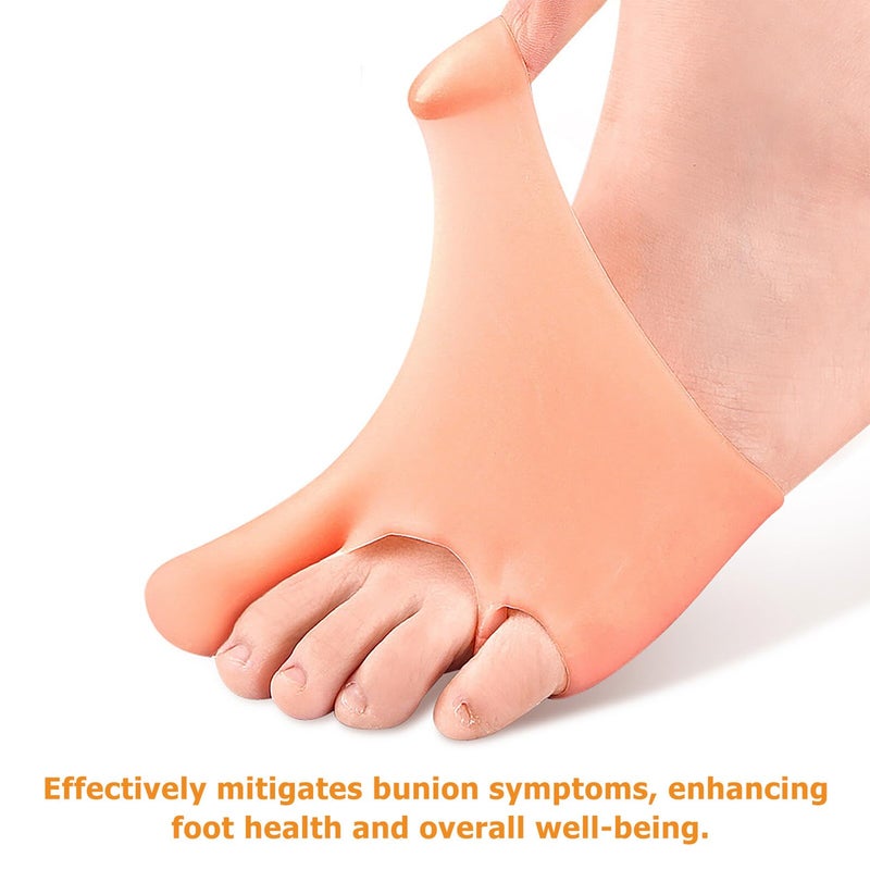 Bunion Corrector Toe Spacers 2 Pairs Forefoot Pads Cushion Sleeve Straightener For Hallux Valgus Relief - Image 3