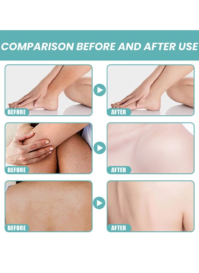 EELHOE - Skin Bath Oil So Soft, Original Skin Bath Oil So Soft, Skin Moisturizing Smoothes And Softens Skin Soft, Skin Moisturizing Smooths And Softens Dry Or Rough Skin 100ML - Image 1
