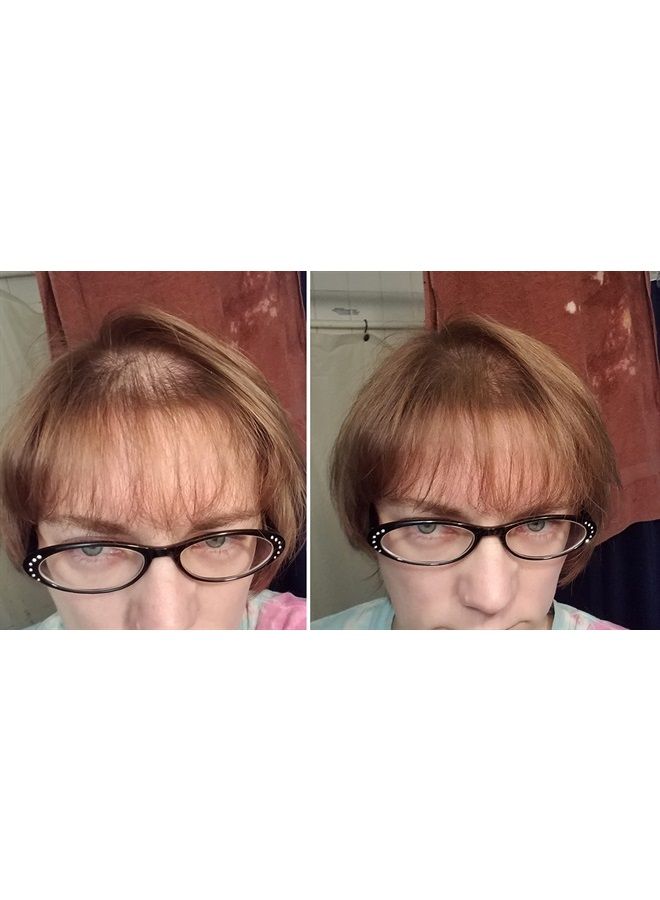 Caboki Hair Loss Concealer. Makes Thin Hair Look 10X Fuller Instantly. Eliminates Bald Spot and Thinning Hair (30G, 90-Day Supply). Light Brown - Image 4