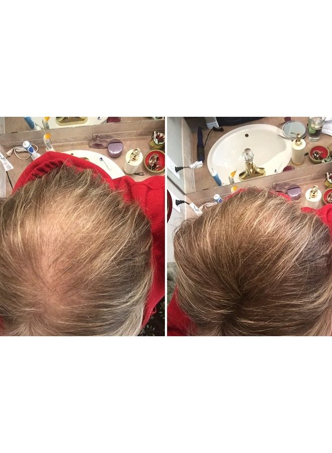 Caboki Hair Loss Concealer. Makes Thin Hair Look 10X Fuller Instantly. Eliminates Bald Spot and Thinning Hair (30G, 90-Day Supply). Light Brown - Image 3
