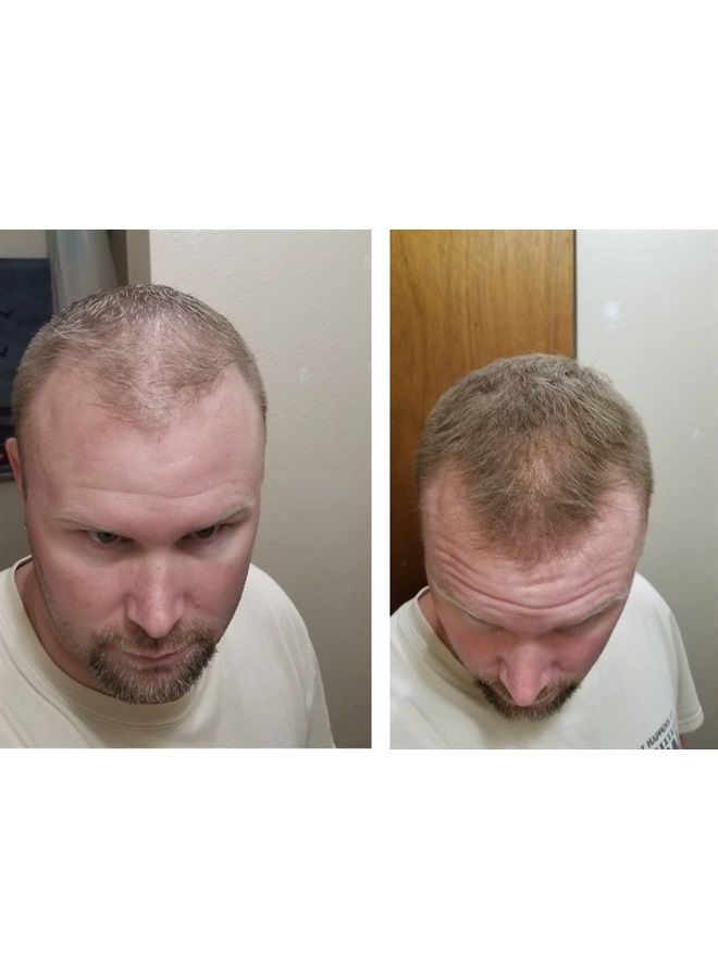 Caboki Hair Loss Concealer. Makes Thin Hair Look 10X Fuller Instantly. Eliminates Bald Spot and Thinning Hair (30G, 90-Day Supply). Light Brown - Image 5