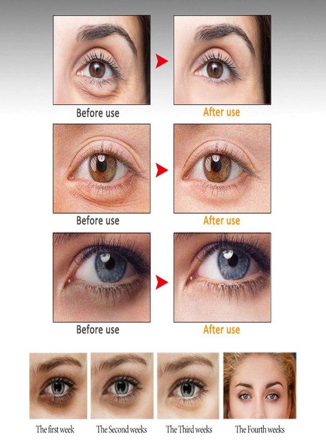 MIESCHER Eye Peptide Serum Massage Roller Nourishing Relieve Loose Eye Bags Dark Circles Skin Care Under Eye Cream for Fine Wrinkles and Puffiness Daily Skincare(Nourishing Grey) - Image 5