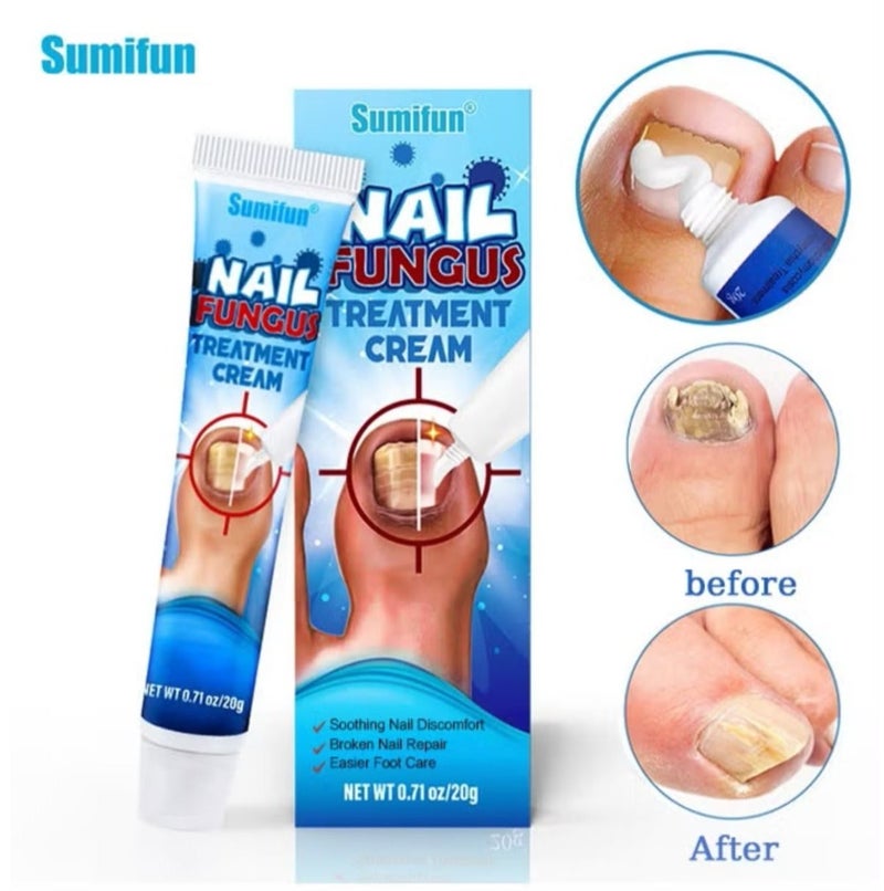 Sumifun Nail Fungus Treatment Cream, Soothing Nail Discomfort,Broken Nail Repair,Easier Foot Care,Bad Nail Care Ointment, Nail Fungus Treatment, Nail Growth and Repair, Nail Treatment Repair Cream 20g - Image 1