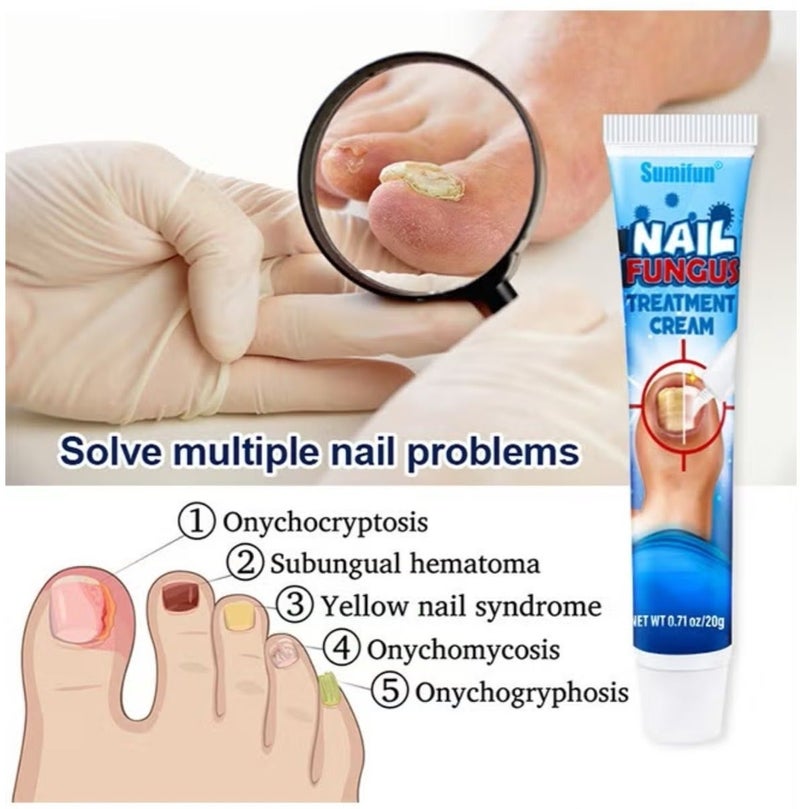 Sumifun Nail Fungus Treatment Cream, Soothing Nail Discomfort,Broken Nail Repair,Easier Foot Care,Bad Nail Care Ointment, Nail Fungus Treatment, Nail Growth and Repair, Nail Treatment Repair Cream 20g - Image 4