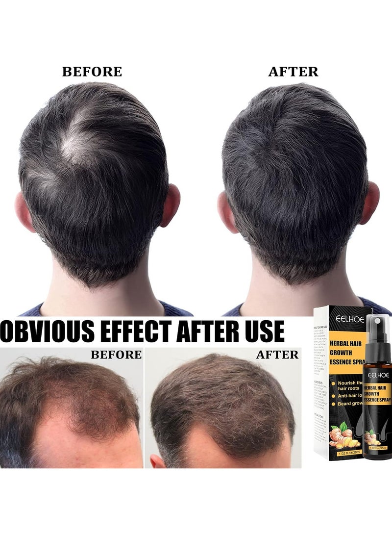 EELHOE Fast Effective Growth Hair Essential Oil Ginger Prevent Hair Loss Scalp Treatment Thicker Hair Care Products For Men Women - Image 3