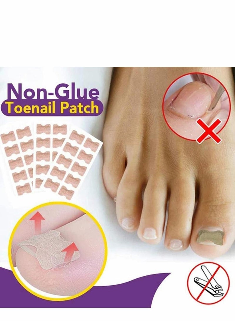 Y&D Ingrown Toenail Correction Stickers, Glue-free Corrector Strips, Painless Pedicure Patch Professional Treatment Tool Foot Care(100 PCS)  - Image 4