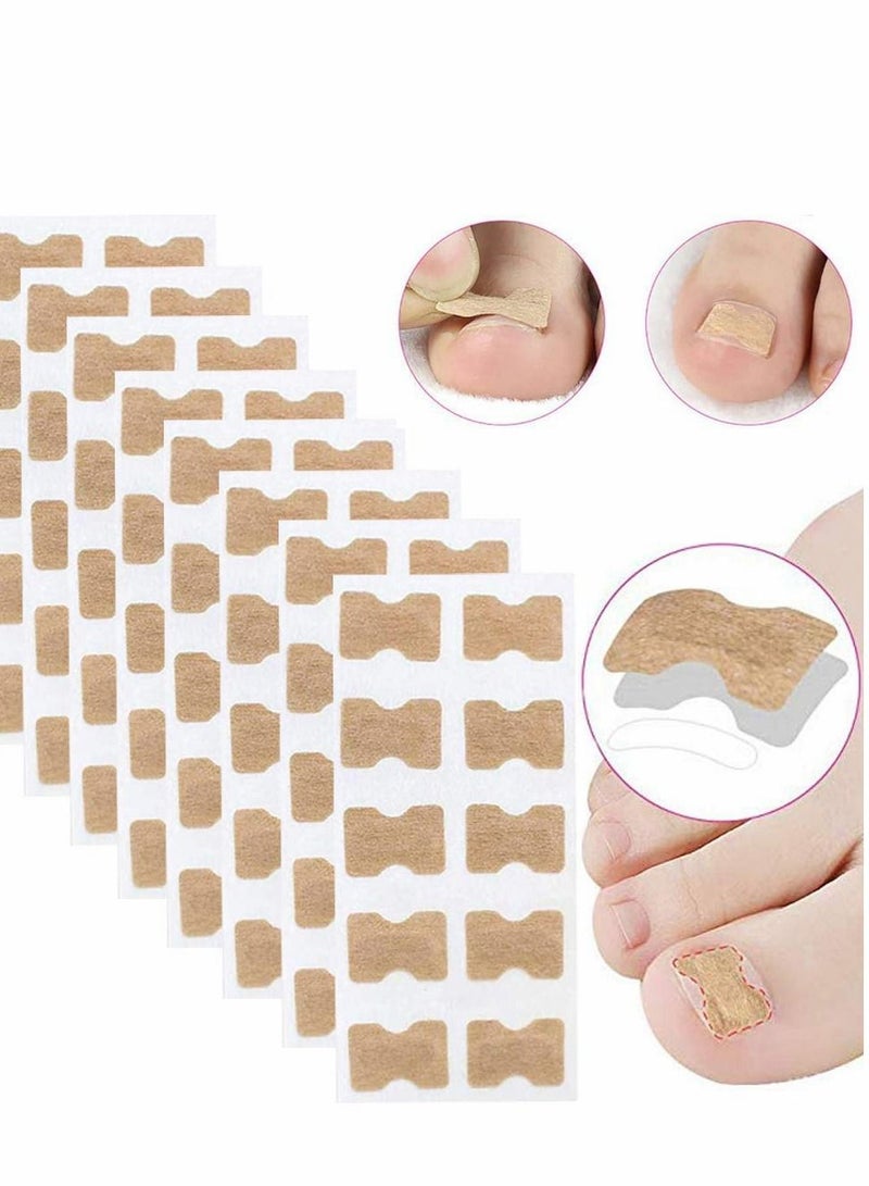 Y&D Ingrown Toenail Correction Stickers, Glue-free Corrector Strips, Painless Pedicure Patch Professional Treatment Tool Foot Care(100 PCS)  - Image 1