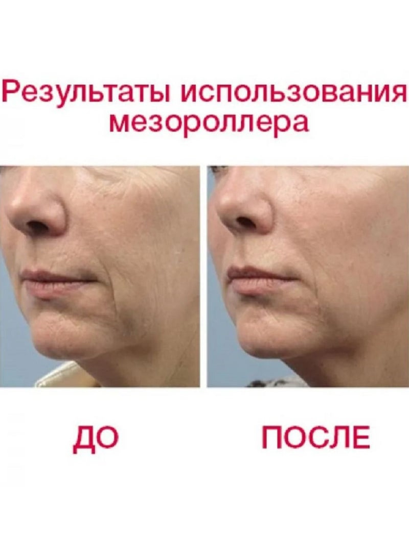 إسكدنيا أداة تساعد على علاج المضاد للشيخوخة وتحسين البشرة المترهلة والتجاعيد - Image 5