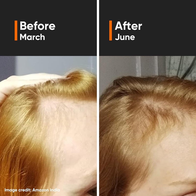 Minimalist Hair Growth Serum With 3 Redensyl 3 Anagain 3 Procapil 5 Capixyl  4 Baicapil 18 Hair Growth Actives  For Hair Fall Control  For Men  Women  30 ml - Image 3