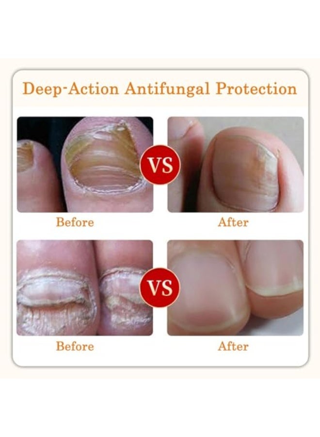 DERMFREE Nail Toenail Cream Fungal Nail Treatment Cream, Antifungal For Toenails, Paronychia u0026 Yellow Damaged Nail Repair, Natural Botanical Formula, Deep Care u0026 Long-Lasting Protection - Image 5