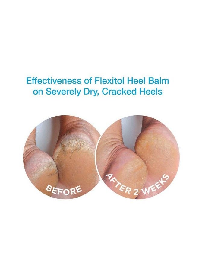 Flexitol Heel Balm 4 Oz Tube (Pack Of 2) Rich Moisturizing & Exfoliating Foot Cream. Fast Relief Of Rough Dry & Cracked Skin On Heelsfeet. For Daily Use And Pedicures. Diabetic Safe And Effective  - Image 4