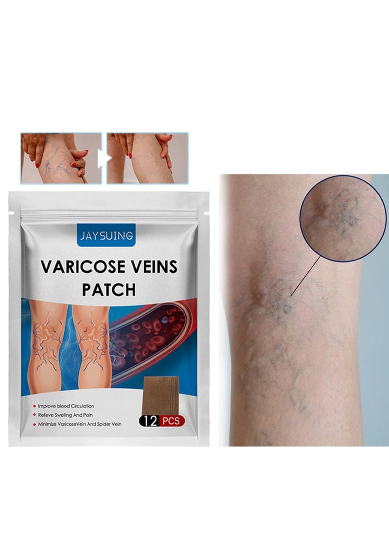 Jaysuing - Varicose Veins Patches for Legs to Improve Blood Circulation Strengthen Capillary Health Relieve Swelling Pain and Fatigue Minimize Varicose Vein and Spider Vein 12 Pcs/Pack - Image 1