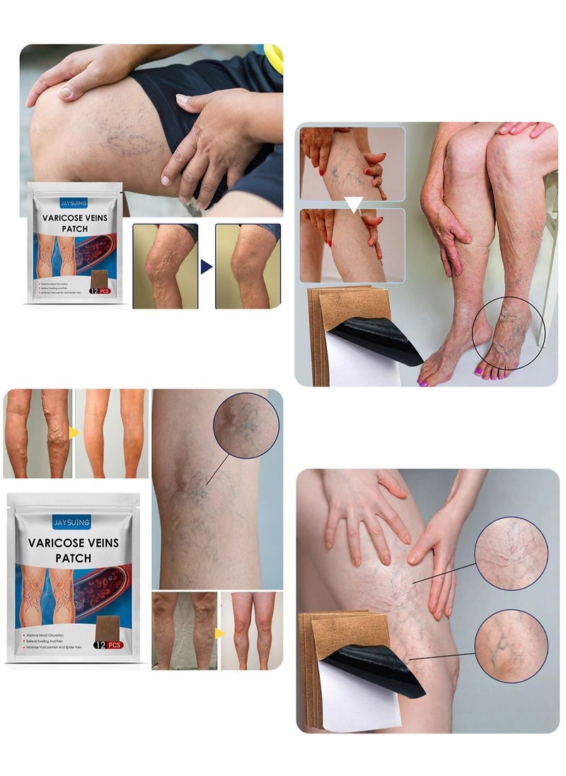 Jaysuing - Varicose Veins Patches for Legs to Improve Blood Circulation Strengthen Capillary Health Relieve Swelling Pain and Fatigue Minimize Varicose Vein and Spider Vein 12 Pcs/Pack - Image 1