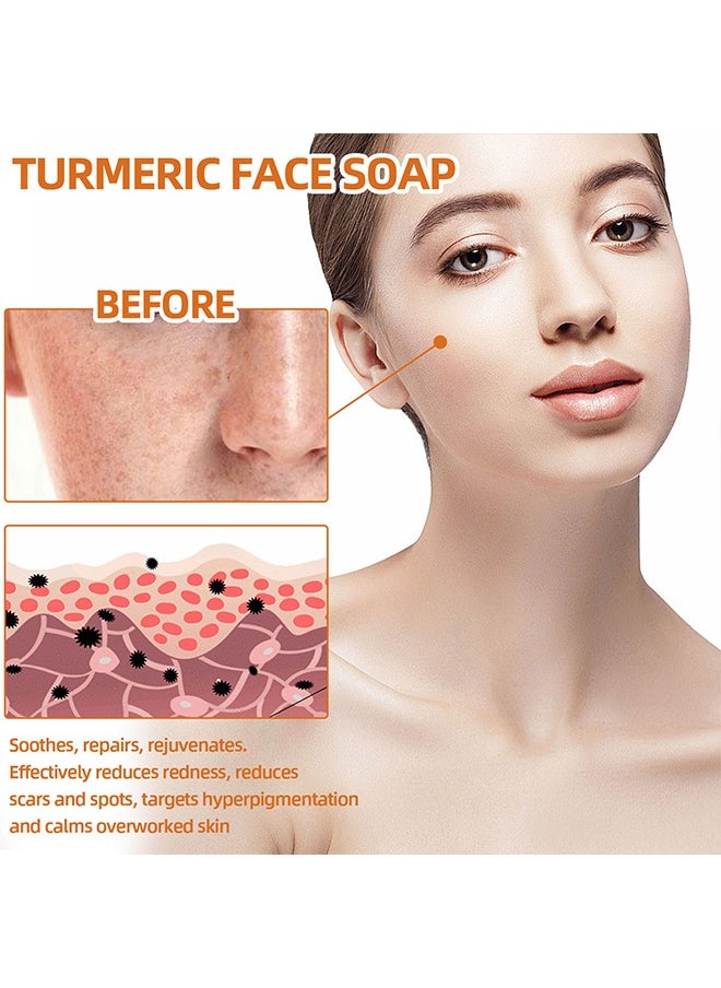 West&Month Turmeric Face Soap, Moisturizing Turmeric Soap For Face And Body, Whitening Turmeric Soap for Acne and Dark Spots, Acne Facial , Multiple Parts Can Be Used 100g  - Image 5