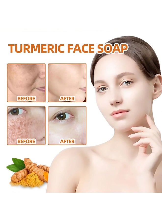 West&Month Turmeric Face Soap, Moisturizing Turmeric Soap For Face And Body, Whitening Turmeric Soap for Acne and Dark Spots, Acne Facial , Multiple Parts Can Be Used 100g  - Image 2