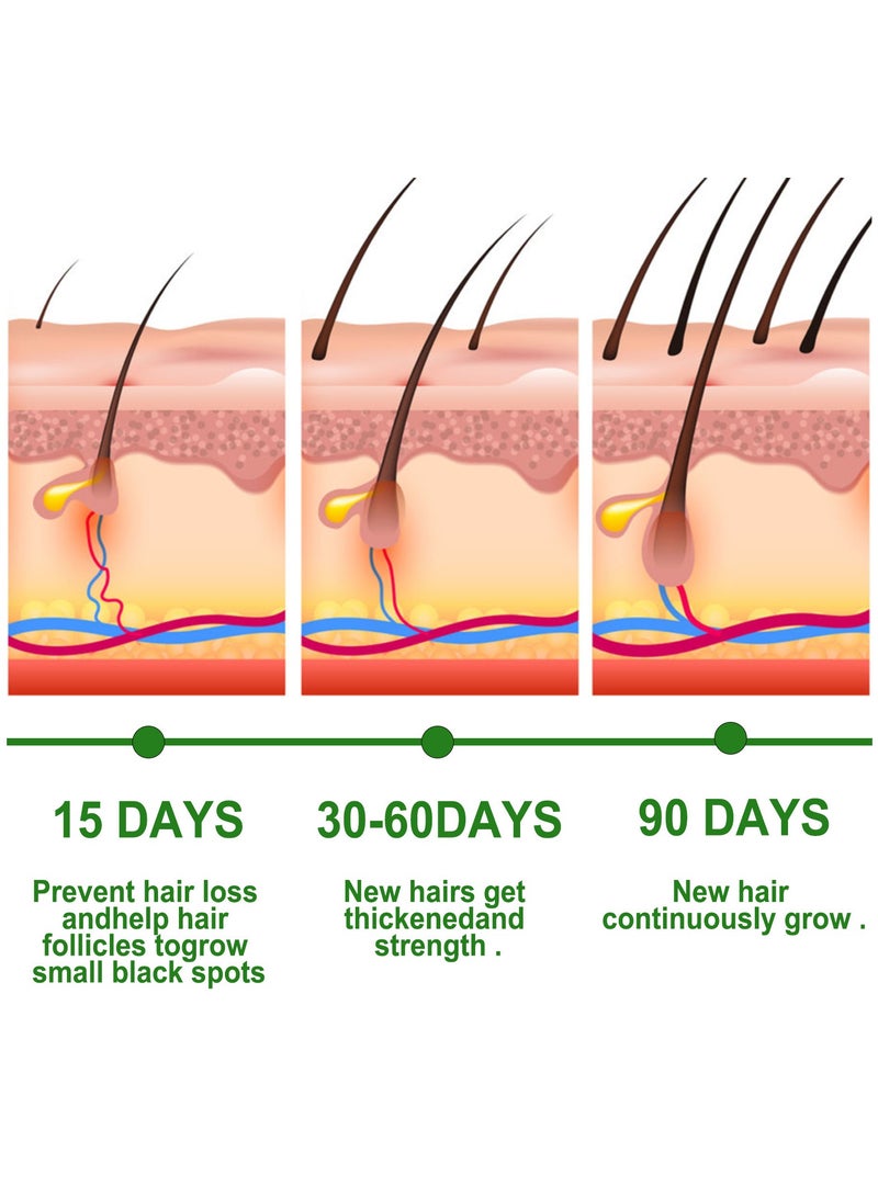 EELHOE 3-PACK Rosemary Hair Oil, Prevents Hair Loss, Nourishes Scalp And Repairs Damaged Hair 30ml*3 - Image 4