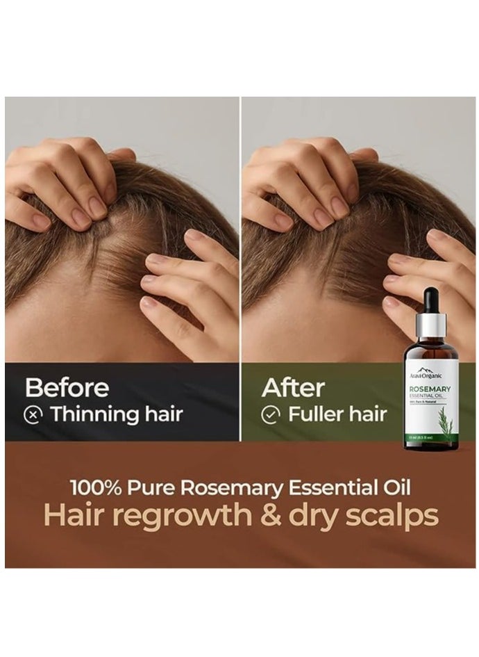 Aravi Organic - Aravi Organic Pure Rosemary Essential Oil 15ml And Pure Castor Oil 200ml Hair Growth Pack of 2 - Image 1