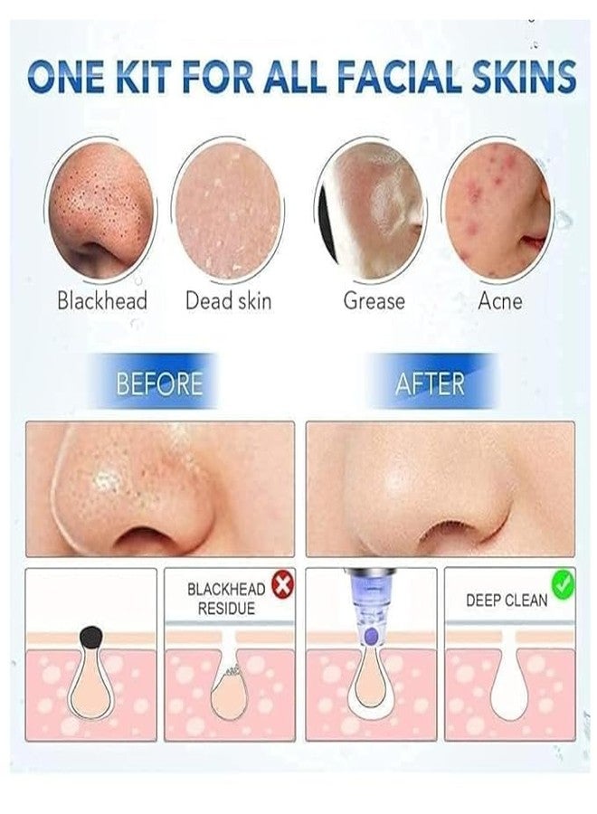 YUGANSHU Beautiful Skin Care Expert Acne Pore Cleaner Vacuum Blackhead Remover Kit Skin Cleaner, Pimple Removal Tool, Acne Removal Tool, Blackhead Remover Tool - Image 4