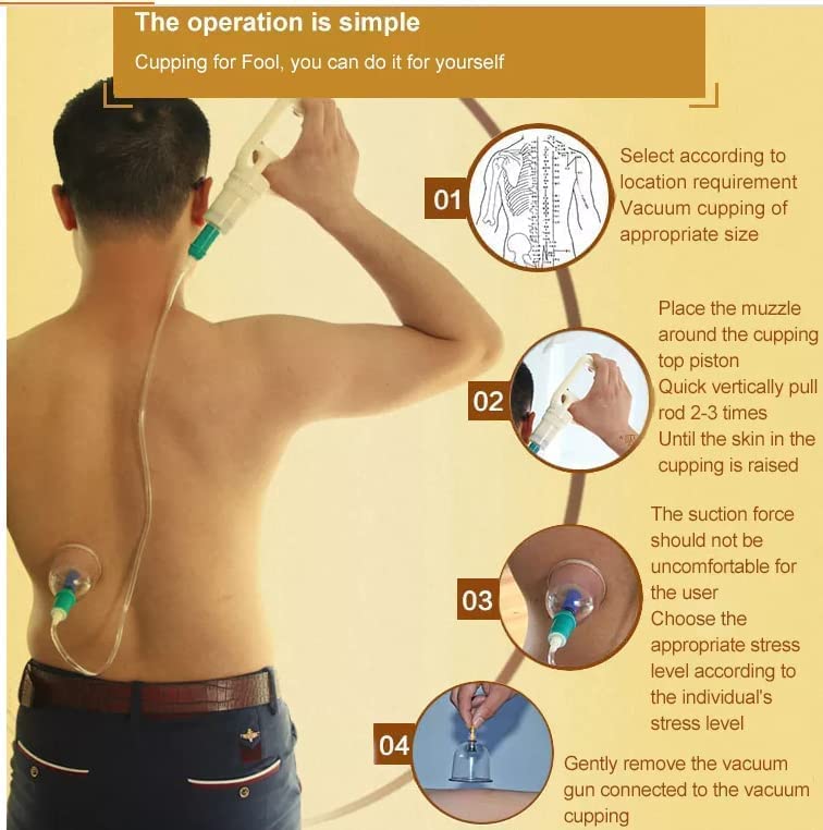 LRK ACUPRESSURE 24 Pcs Hijama acupuncture Massage Cans Cups Vacuum Cupping Kit Pull Out Vacuum Apparatus Therapy Relax M - Image 1