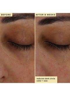 FARMACY Wake Up Honey Eye Cream for Dark Circles and Puffiness - Under Eye Cream for Wrinkles and Bags Under Eyes - Formulated with Caffeine & Vitamin C  - Image 4