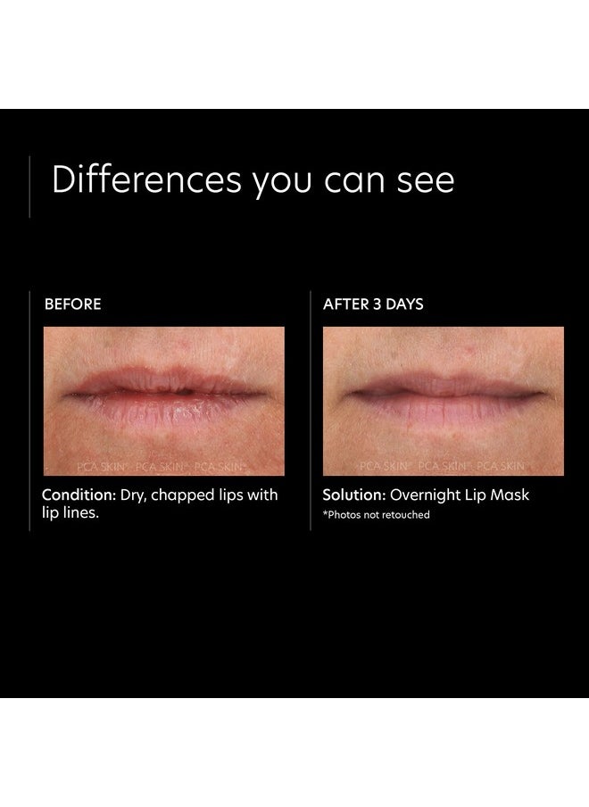 PCA SKIN PCA SKIN Overnight Lip Balm Mask - Ultra-Moisturizing Lip Skin Care Treatment, Restores Moisture & Hydrates Dry, Chapped Lips while Sleeping (0.46 oz)  - Image 4